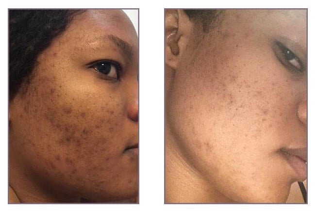 Savon lumière - corrige les imperfections du visage