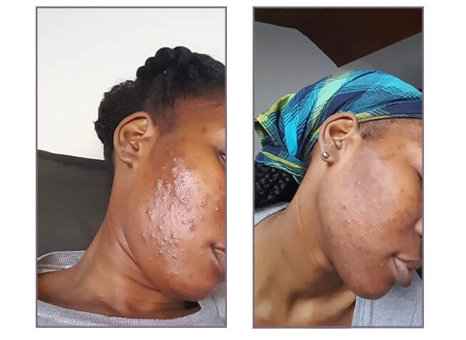 Savon lumière - corrige les imperfections du visage